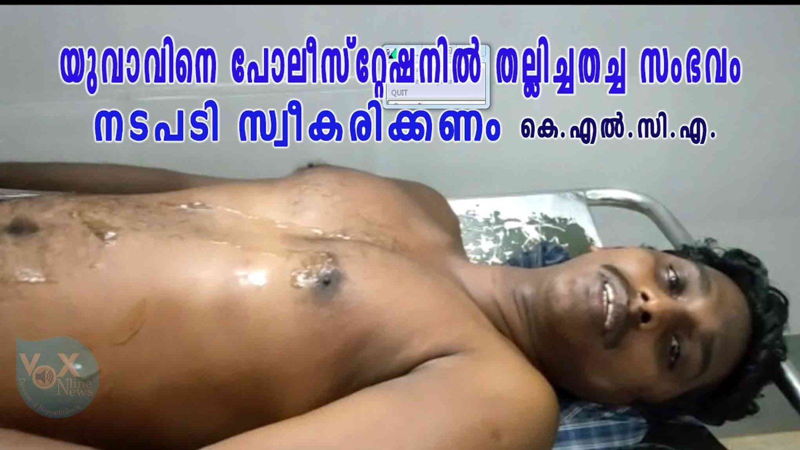 യുവാവിനെ പോലീസ്റ്റേഷനില്‍ തല്ലിച്ചതച്ച സംഭവം കുറ്റവാളികള്‍ക്കെതിരെ നടപടി സ്വീകരിക്കണം; കേരള ലാറ്റിന്‍ കാത്തലിക് അസോസിയേഷന്‍