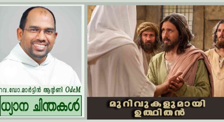 മുറിവുകളുമായി ഉത്ഥിതൻ (യോഹ 20:19-31)